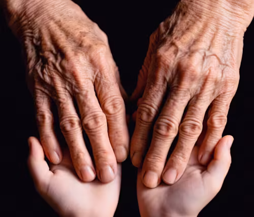 Understanding Arthritis and Its Impact on Daily Life